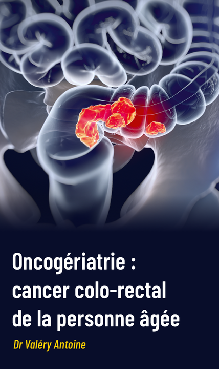 Cancer colo-rectal de la personne âgée : attention aux préjugés en cas de localisations secondaires ou de troubles cognitifs chroniques